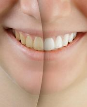 Praxis für Zahnheilkunde, Michael Meurer Bild 3