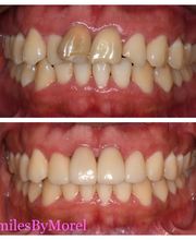 Smiles By Morel image 20