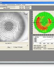 Studio Ottico Cervo SA Bild 5