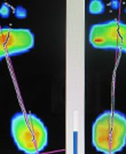 Ook hier werken we met moderne aparatuur om uw mobiliteit, stand en looppatroon in kaart te brengen.