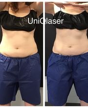 UniQ Laser Center Watertown image 7