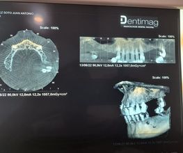 229678255-1-dbmDAbcz1U1663174505666.jpeg
