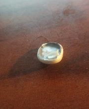 South Plainfield - Jersey Dental Group image 3