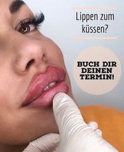 PrettyDoc Düsseldorf - Hyaluron und Botox Düsseldorf Bild 4