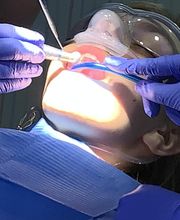 Clínica Sasermed Dental Buhaira. IMPLANTES DENTALES imagen 10