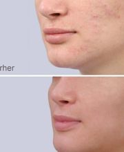 Future Beauty by Troxler Bild 12