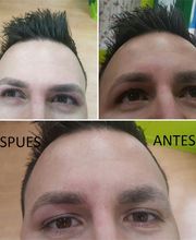 Royal Depil India imagen 15