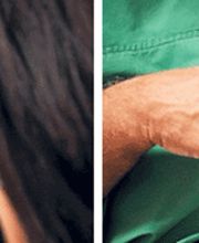 Medical Aesthetic Fettabsaugen Dr. Urs Benz Bild 4