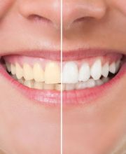 Centre Dentaire Chêne-Bourg Bild 9