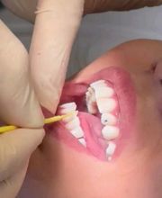 Zahnarztpraxis Jonaport Dr. med. dent. Alexander Kroneberger Bild 12