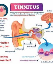 Tinnitus-Experten