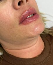 Estética Raphaela Santana imagen 16