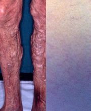 Consulta Barreiro-Vascular (Drs. A. Barreiro Mouro y J. Barreiro Veiguela) imagen 16