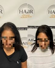 Hair clinic solution spécialiste en micropigmentation du cheveux à Marseille image 3