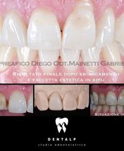 Dentalp SA Bild 7