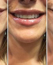 Miami Center for Dermatology image 15