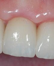 Bodensee Implantatzentrum Dr. Wolfgang Prinz MDSc Zahnarzt/ Implantologie Bild 7