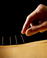 Acupuntura Yolanda Dorado imagen 11