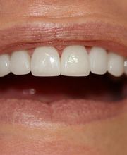clinica-dental-jose-castro-herrero-sonrisa-01.jpg