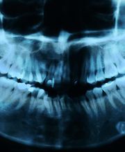 Praxis für Zahnheilkunde, Michael Meurer Bild 2