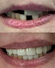 Michael W. King DDS image 16