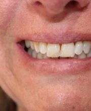 Hamilton Family Dentistry image 19