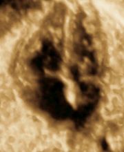 3D-Herzecho in SSW 22