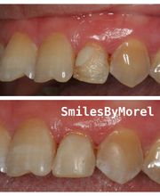 Smiles By Morel image 8