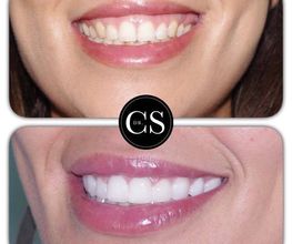 Carlos Saiz Smile imagen 2
