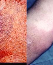 Consulta Barreiro-Vascular (Drs. A. Barreiro Mouro y J. Barreiro Veiguela) imagen 15