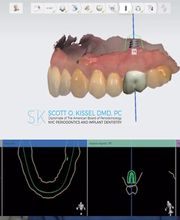 NYC Periodontics and Implant Dentistry: Scott O. Kissel, DMD, PC image 19