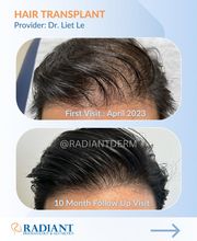 Radiant Dermatology & Aesthetics - Spring image 10