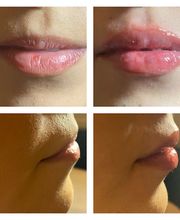 Sheer Skin Spa image 13