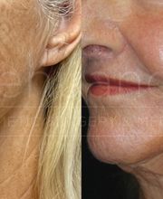 Renuance Cosmetic Surgery and MedSpa image 15