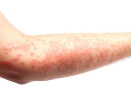 abdermatologia imagen 9