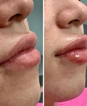 dermani MEDSPA Roswell image 12