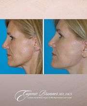 Eugenie Brunner, MD, FACS image 1