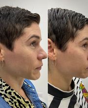 Juvenalia Brío | Botox, Hydrafacial & Ultraformer - Condesa / Roma Norte CDMX imagen 10
