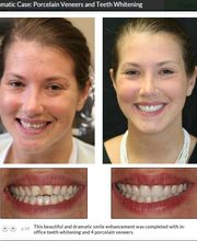 The Dental Design Center - Cosmetic, Implant & General Dentistry image 19