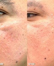 360 Surgery Center image 17