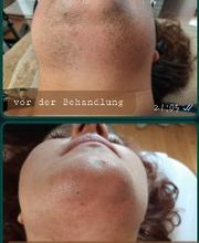 Feel Beautiful by Nicole - Dauerhafte Haarentfernung, Hautverjüngung und Beckenbodentraining Bild 16