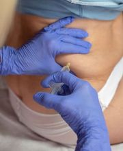 SCHÖNHEILEN - Ina Leitner | Hormonbehandlung - Abnehmspritze - Faltenbehandlung Bild 7