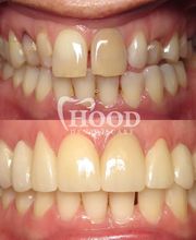 Hood Dental Care - Watson Office image 8