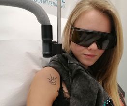 ENDLICH OHNE Tattooentfernung Filiale Brandenburg Bild 7