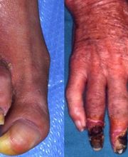 Consulta Barreiro-Vascular (Drs. A. Barreiro Mouro y J. Barreiro Veiguela) imagen 10