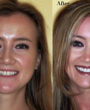 Smiles By Morel image 12