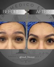 Dr Alexis Fernandez | Medicina Estetica imagen 3