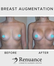 Renuance Cosmetic Surgery and MedSpa image 6