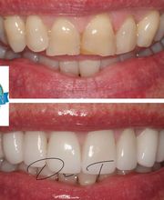 Flawless Smile Dentistry Claremore image 10