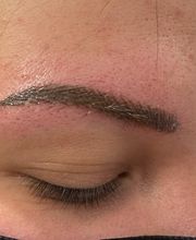 Beauté des neiges image 2